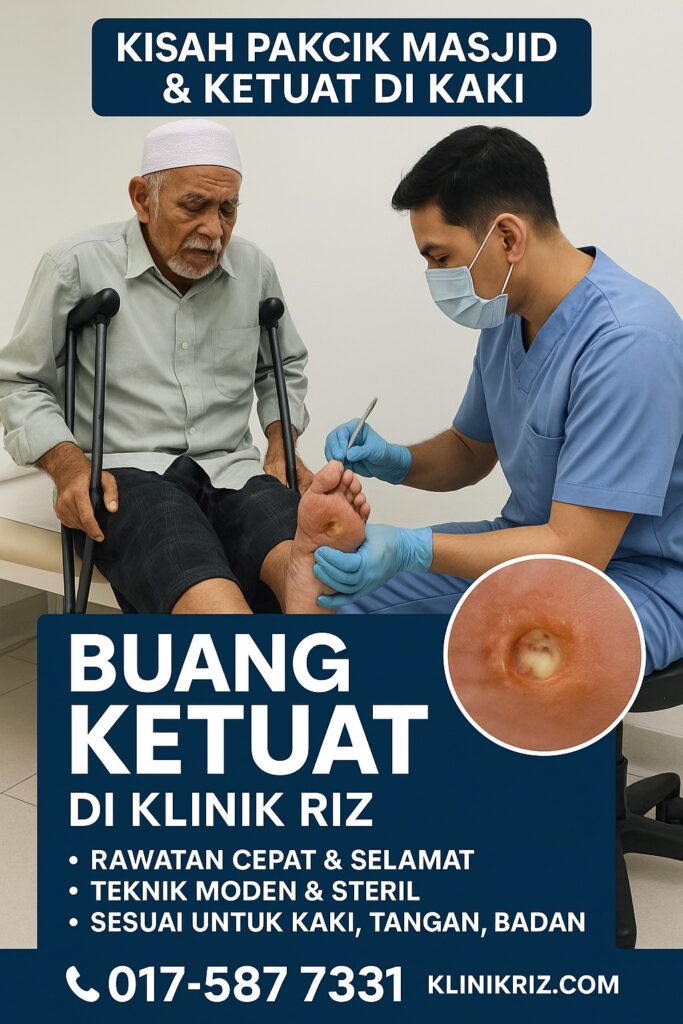 Rawatan Buang Ketuat