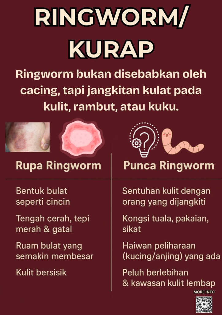 RINGWORM / KURAP