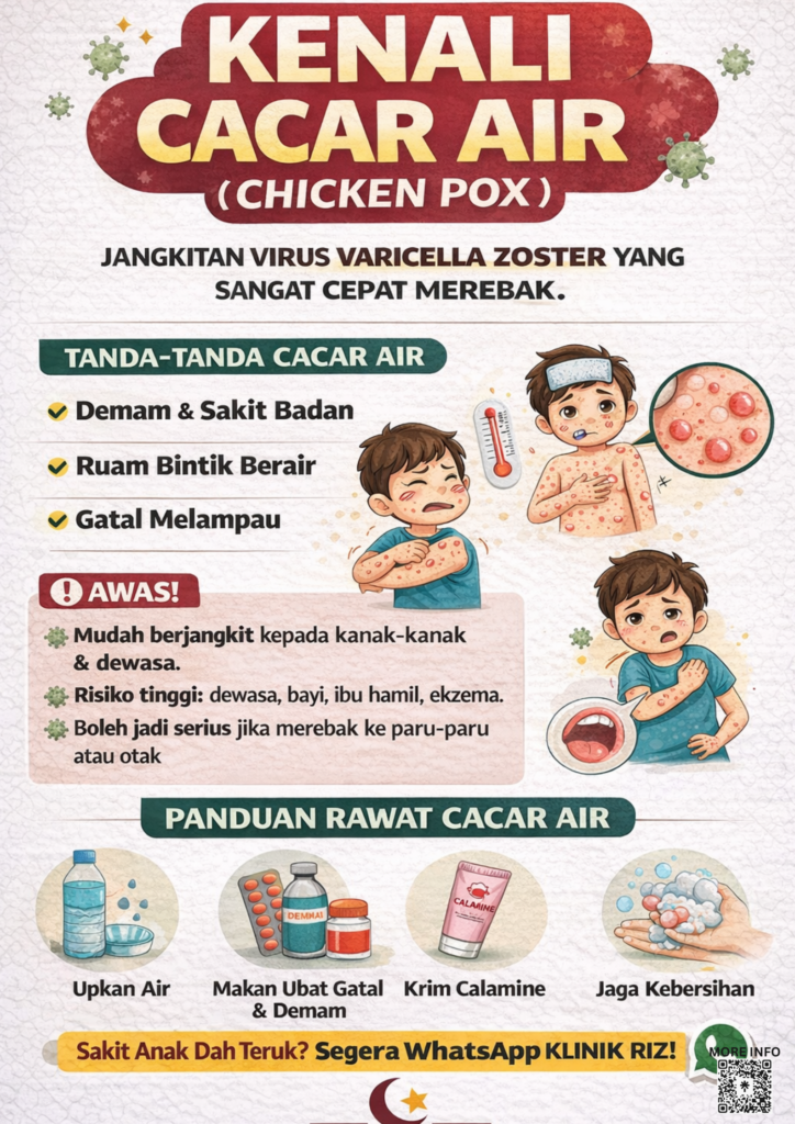 CHICKEN POX (CACAR AIR)