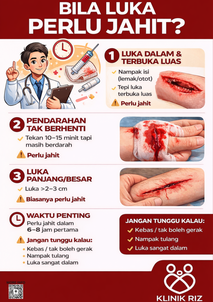 BILA LUKA PERLU JAHIT