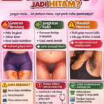 KENAPA KULIT KELANGKANG JADI HITAM?