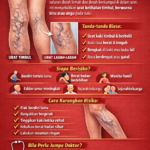 URAT TIMBUL DI KAKI?