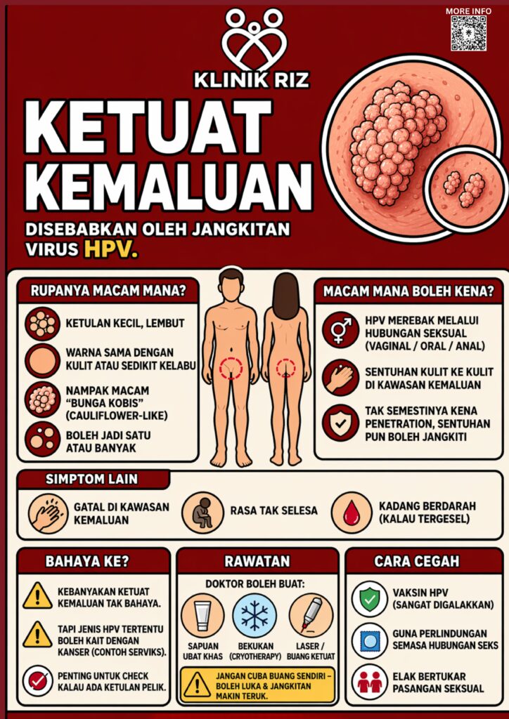 KETUAT PADA KEMALUAN