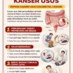 3 TANDA KANSER USUS