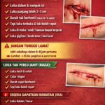 BILA LUKA PERLU JAHIT?