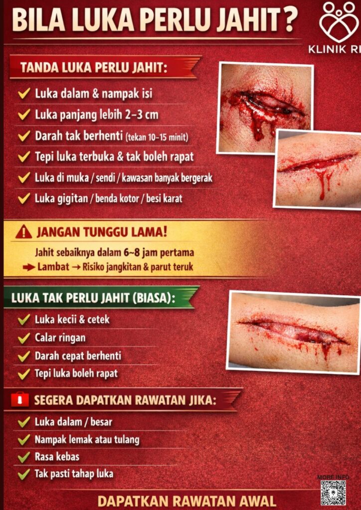 BILA LUKA PERLU JAHIT?