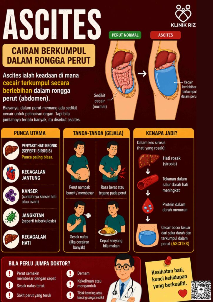 ASCITES