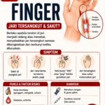 APA ITU TRIGGER FINGER