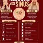 RESDUNG VS SINUS